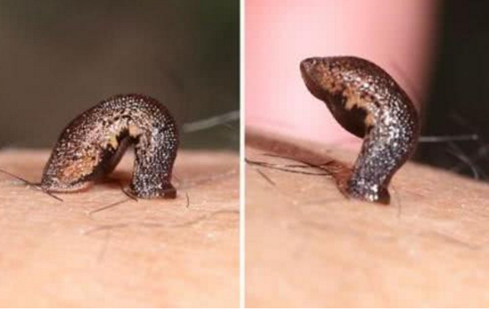 如果人稍不注意把蚂蟥吃进肚子它能存活下去吗真相让人错愕