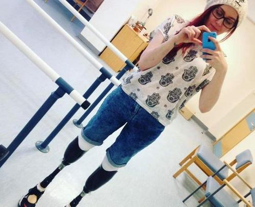 漂亮女孩因病失去双腿,成为欧洲第一位双腿截肢的模特