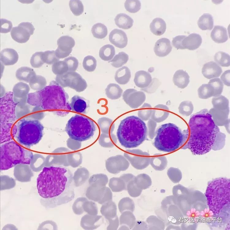 看图识细胞(第61期)_核仁