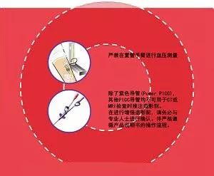 液體滲出置管口有無疼痛或硬結置管肢體有無紅腫,疼痛置管肢體皮膚