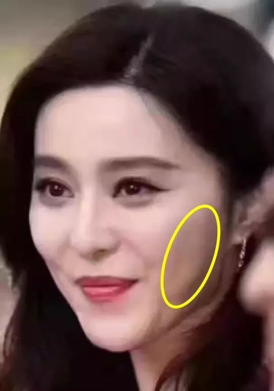 线雕揭秘 | 原来这些一线女星都做过线雕!