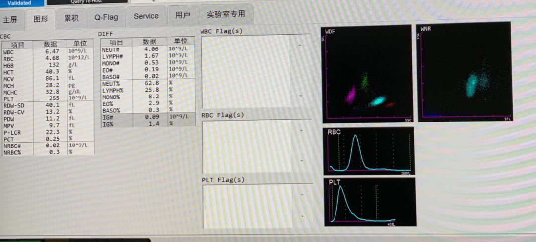 红细胞平均血红蛋白浓度mchc小指标大作用