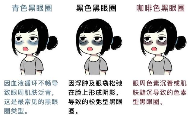 咱们先说说,黑眼圈拢共分几种2 马应龙痔疮膏能祛黑眼圈而且经常这么