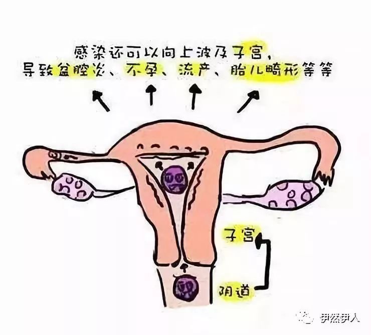 女性健康2十女九炎