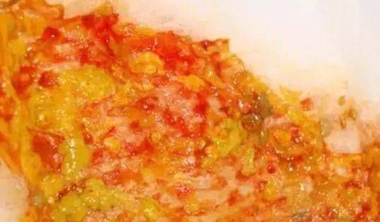 宝宝一旦拉出这个颜色的便便,不要耽误,立刻就医!_大便