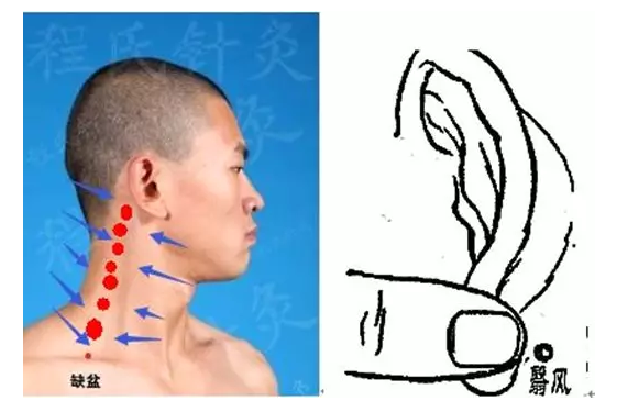 耳后高骨大筋图片