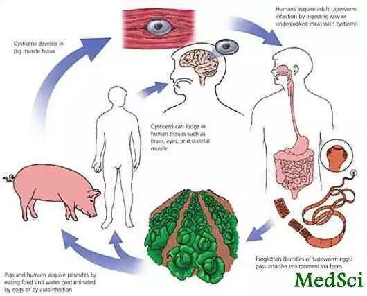 豬肉絛蟲病患者是囊蟲病的惟一傳染源.