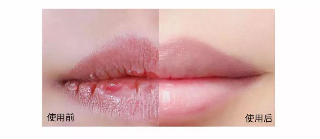 吴佩慈推荐过的日本资生堂moilip润唇膏