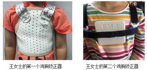 鸡胸治疗新技术:3d定制鸡胸矫正器–2019全国儿童普胸外科新技术论坛