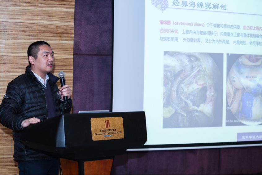 空军军医大学唐都医院衡立君教授分享了"神经内镜下经鼻蝶经海绵窦经