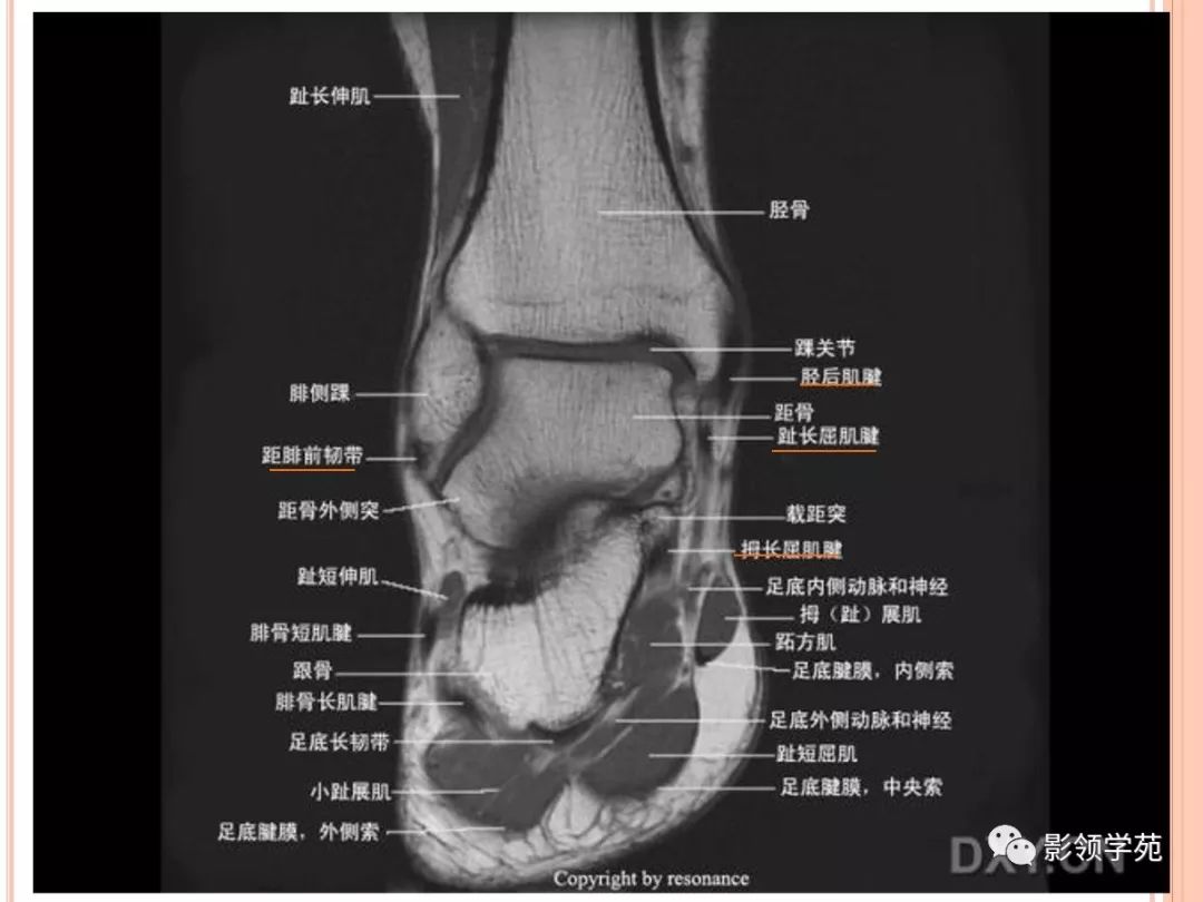 踝关节(ankle joint),由胫,腓骨下端的关节面与距骨滑车构成,故又名