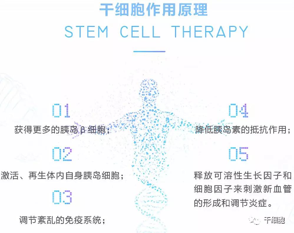 图解干细胞疗法治疗糖尿病的作用原理