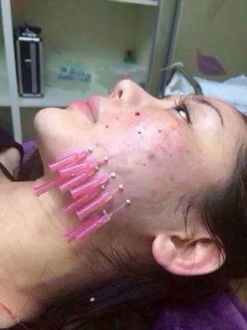 线雕是怎么做的过程(线雕是怎么做的过程视频)