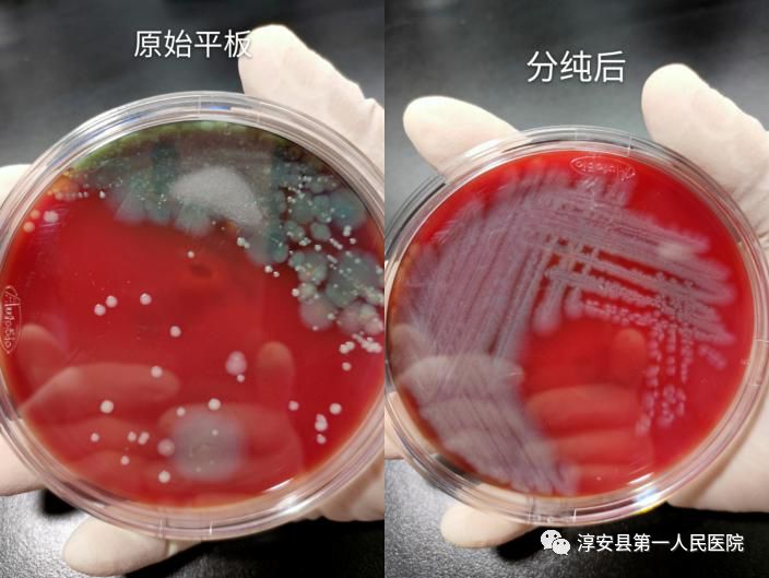 铜绿假单胞菌菌落颜色图片