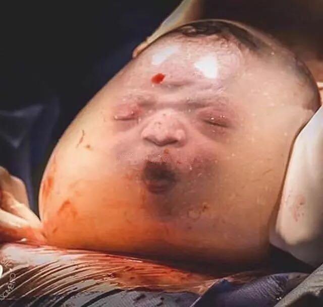 外星男人怀孕生孩子图片