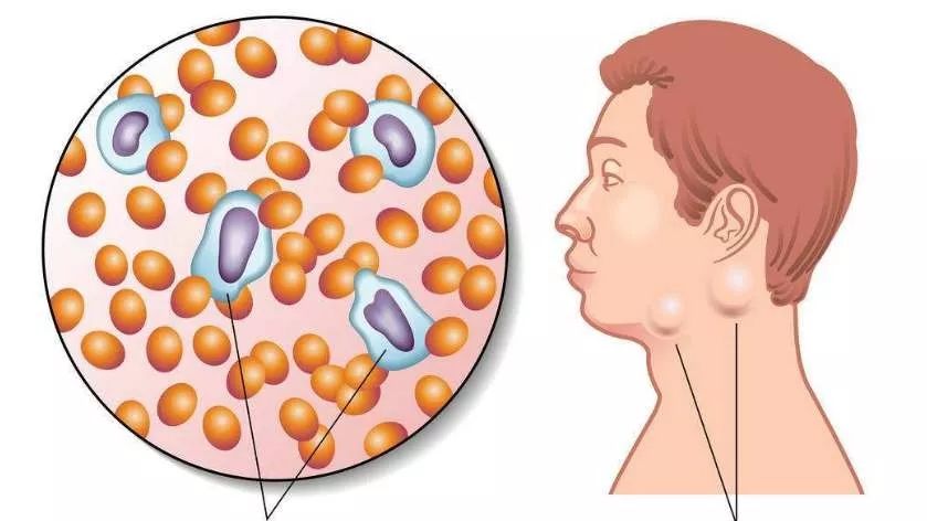 肿么了?淋巴结向你发出求救信号!_区域
