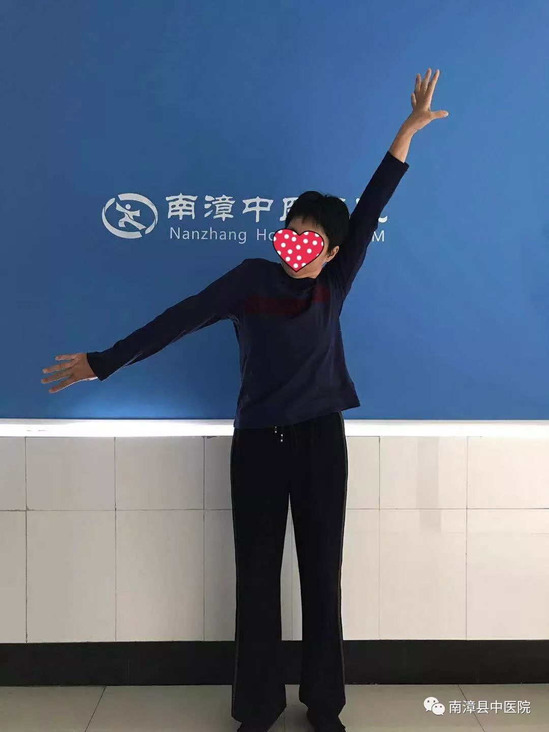 骨科分享胳膊肢不能外展不能摸头不能脱衣服治疗后