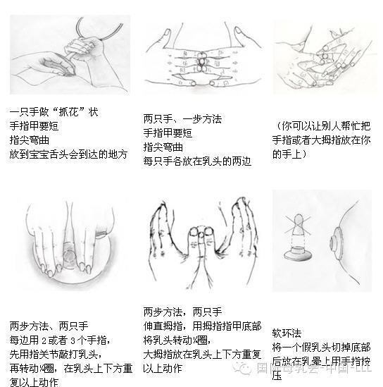 乳房感觉特别胀怎么回事该怎么做