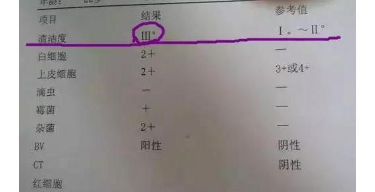 婦科檢查報告單看不懂?看這裡就夠了!