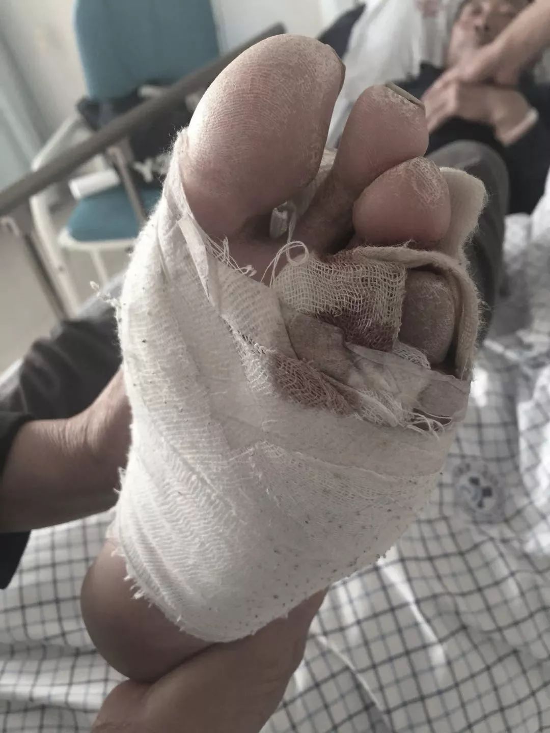 健康知识热水泡脚差点截肢医生这9类人千万要注意