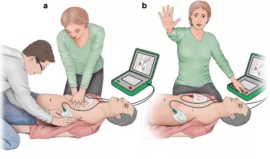 电除颤的正确部位图图片