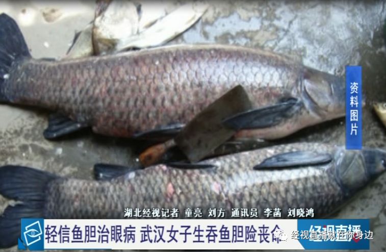 鱼胆明目 武汉一女子生吞鱼胆 结果当晚肝衰竭 曹女士 鱼胆明目 武汉一女子生吞鱼胆 结果当晚肝衰竭 曹女士