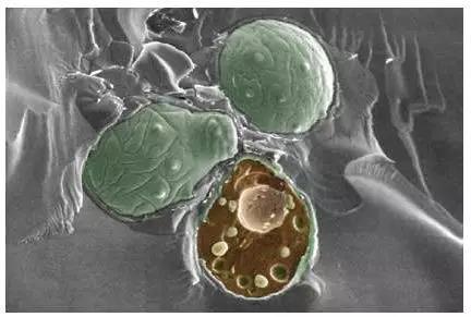 头屑的尴尬,都在地铁车厢里