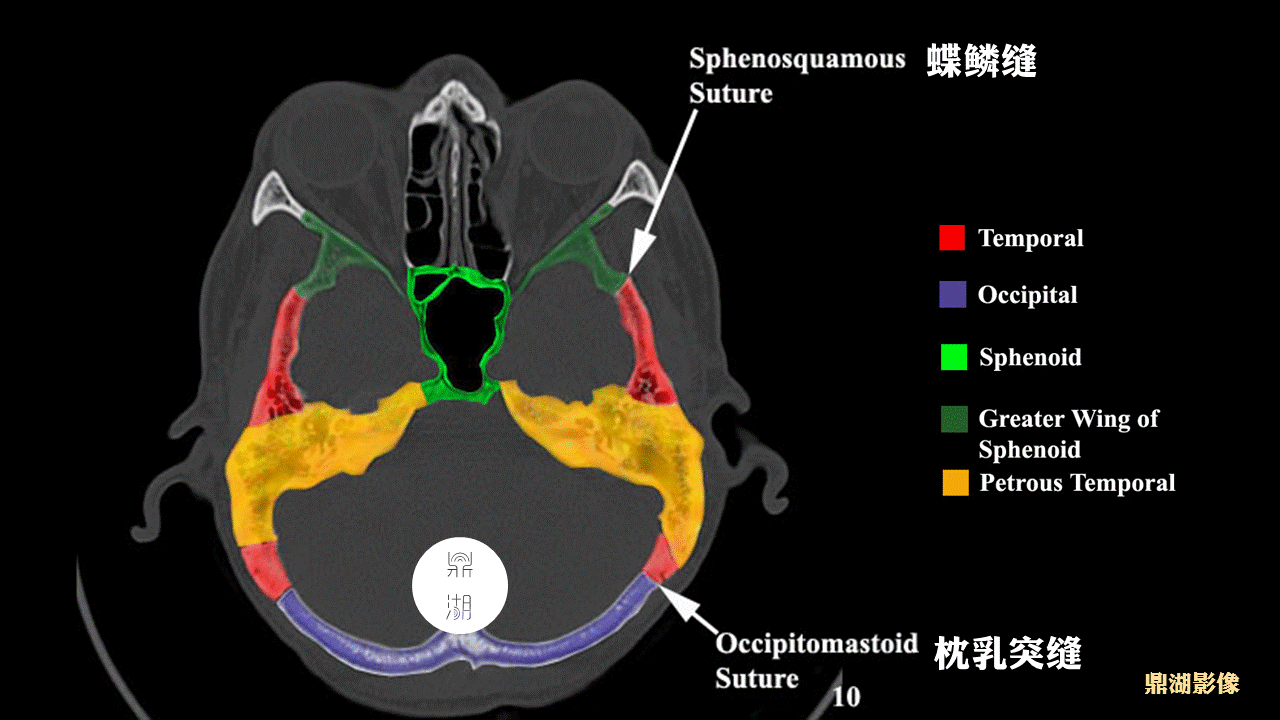 超精致颅底断层解剖(必点收藏)