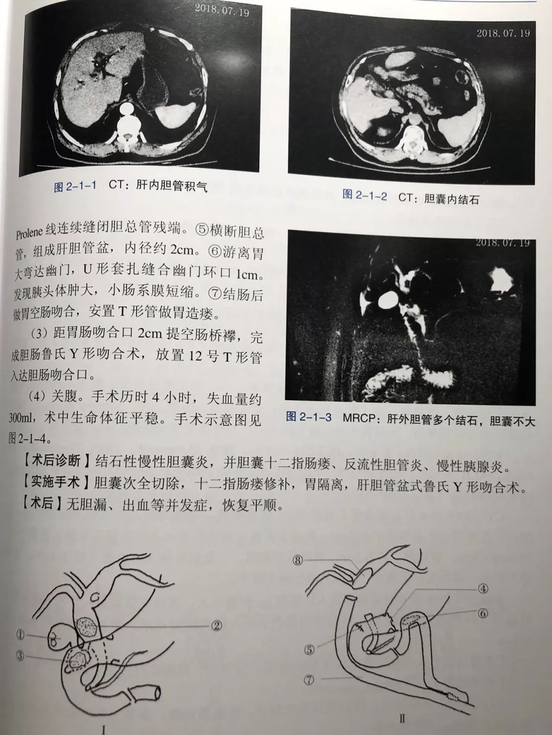 吳金術教授第16本醫學專著《複雜肝膽胰疾病診治難點與創新》出版