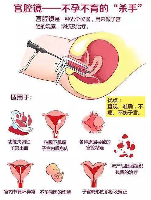 术后一周内可能有阴道少量出血,如达月经量请速复诊;2