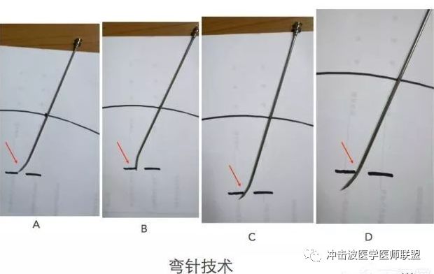 针尖 针尾卡槽方向 针尖斜面方向,针的长度直径材质等等熟练应用弯针