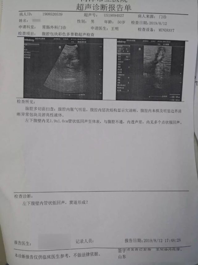 盲肠炎怎么检查图片