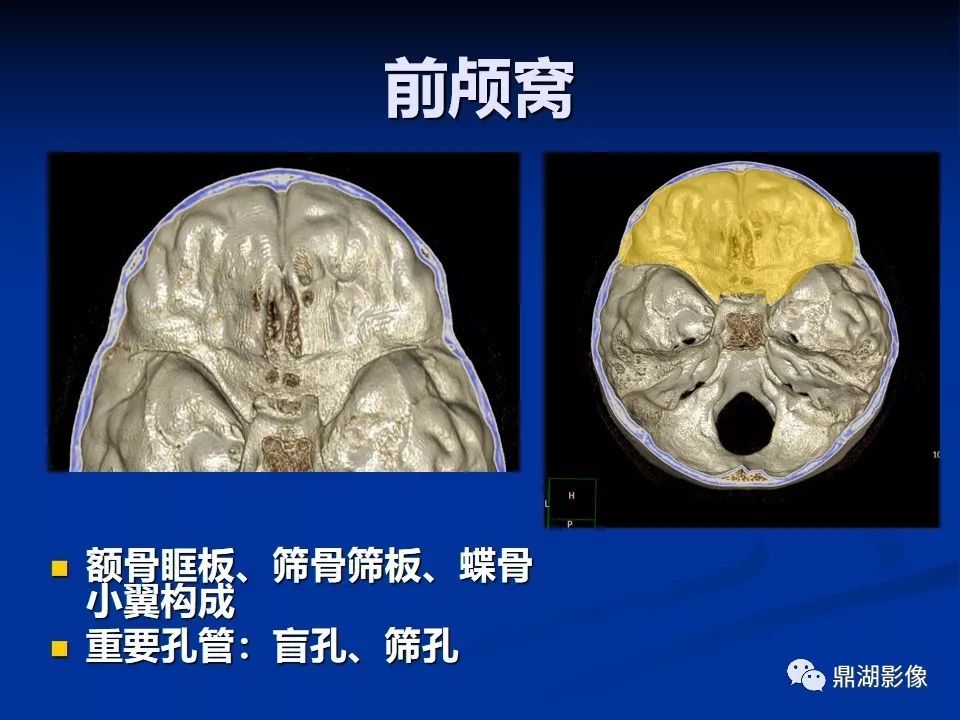 必點收藏 | 超詳細顱底影像解剖,千萬不要錯過