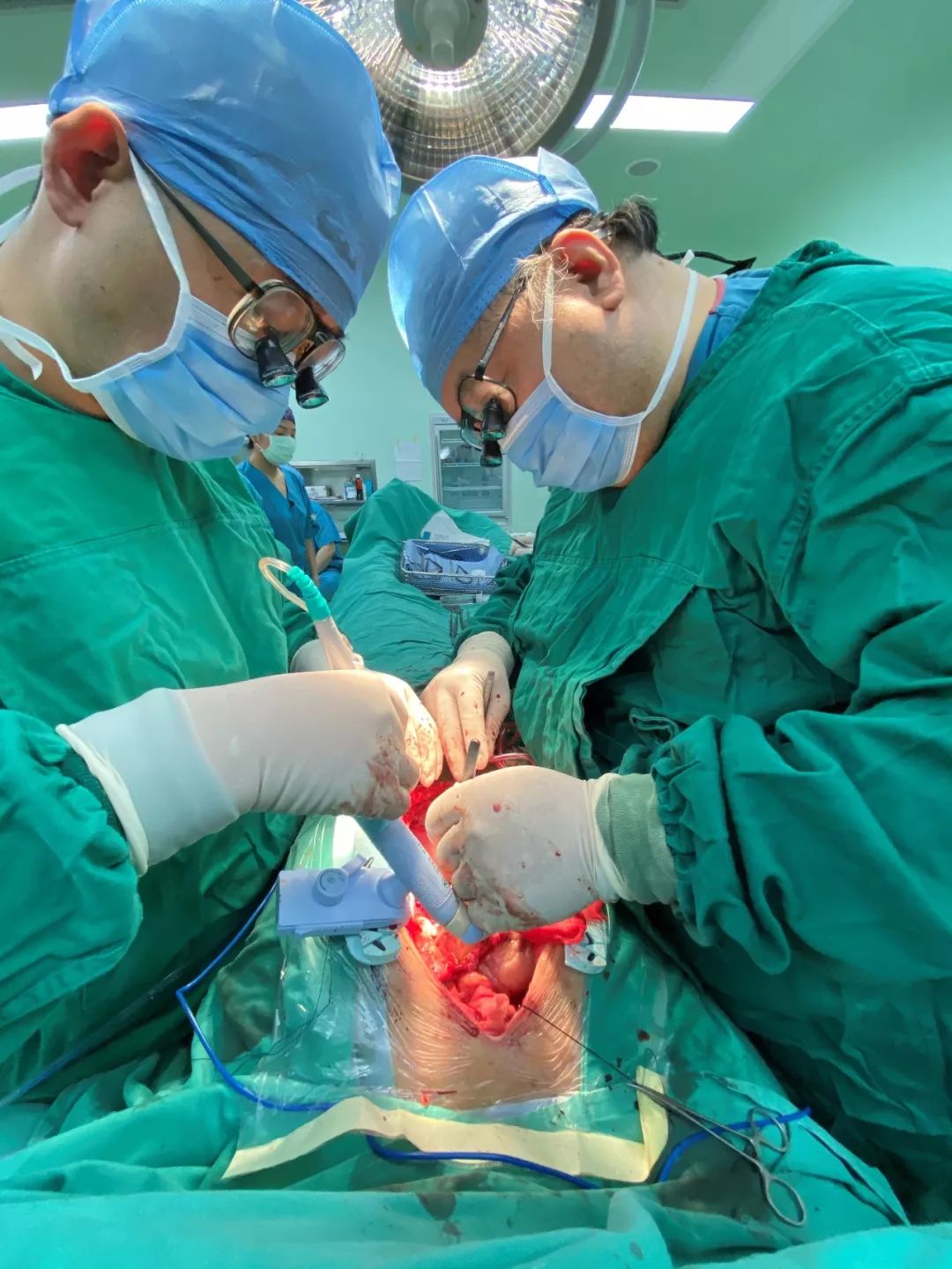 跳动的心——记东直门医院成功开展不停跳冠状动脉旁路移植术_心脏