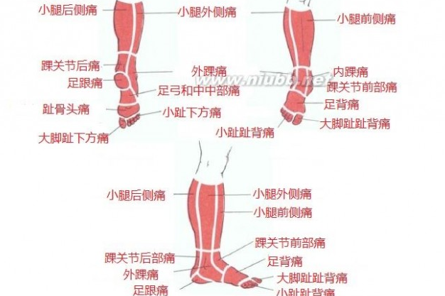 叶颖华肌筋膜激痛点示意图