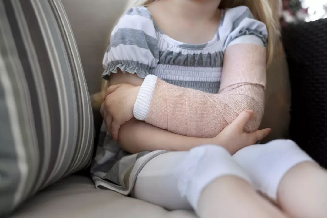 儿童骨折成人骨折成长期儿童户外运动注意防护