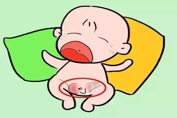 新生儿尿道下裂女宝图片