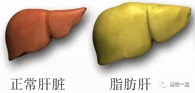 脂肪肝家底全抖落身体管理是持之以恒的事,如果你不按常规出牌身体也