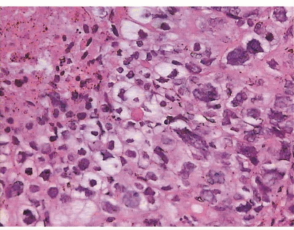 图6 病理切片(图片来自 作者提供)2.