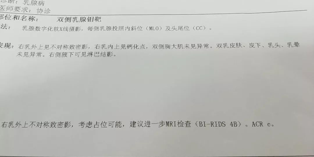 【邮医 61 科普】乳腺钼靶报告怎么看?