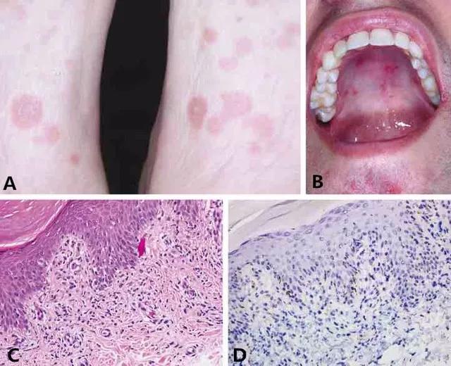 人生如戏全靠演技性传播疾病中也有一个演技精湛的角色