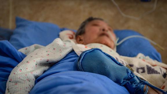 健康讲座老年人说胡话产生幻觉是个危险的信号谵妄状态