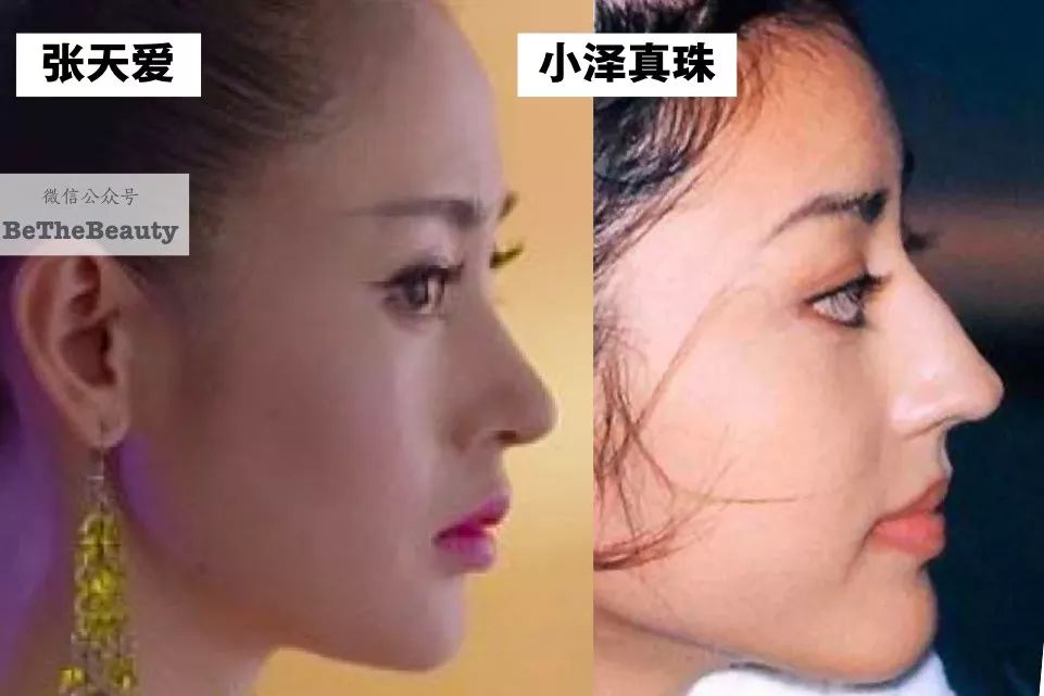 鞠婧祎美上热搜:从骨相硬伤到真·脱胎换骨,问医生不如问她的变美心机