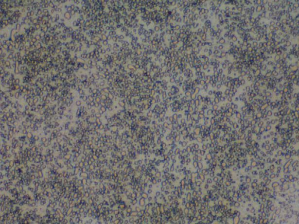 球状珠光体500x球状珠光体,经球化退火获得,渗碳体成球粒状分布在铁素