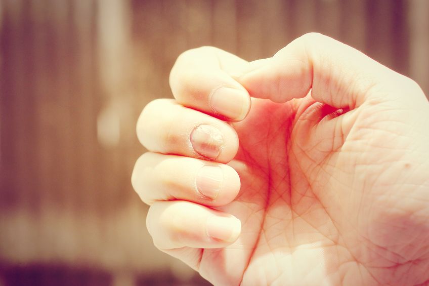 体内有病,尿液先知?若尿液出现这种情况,警惕