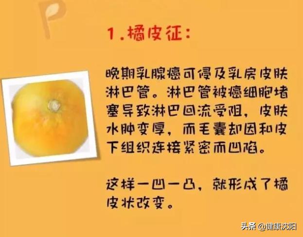 乳腺酒窝征图片图片