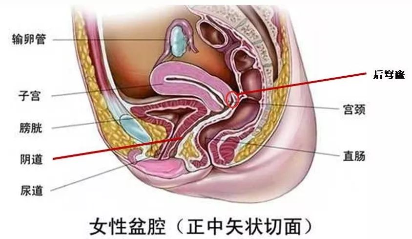 子宫穹窿的位置图片图片