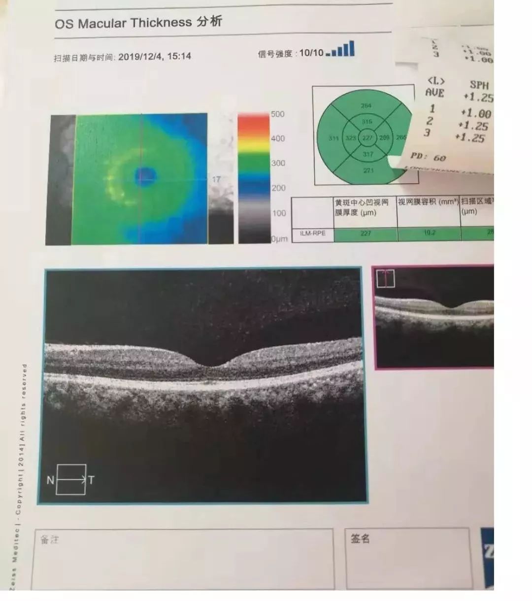 好消息我院引进全县首台最先进的眼科诊断设备医疗诊断水平再迈新台阶