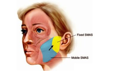 无可替代的抗衰地位:smas筋膜层提升_面部