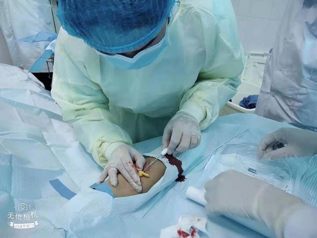 石阡县中医院肿瘤科成功开展首例picc置管术